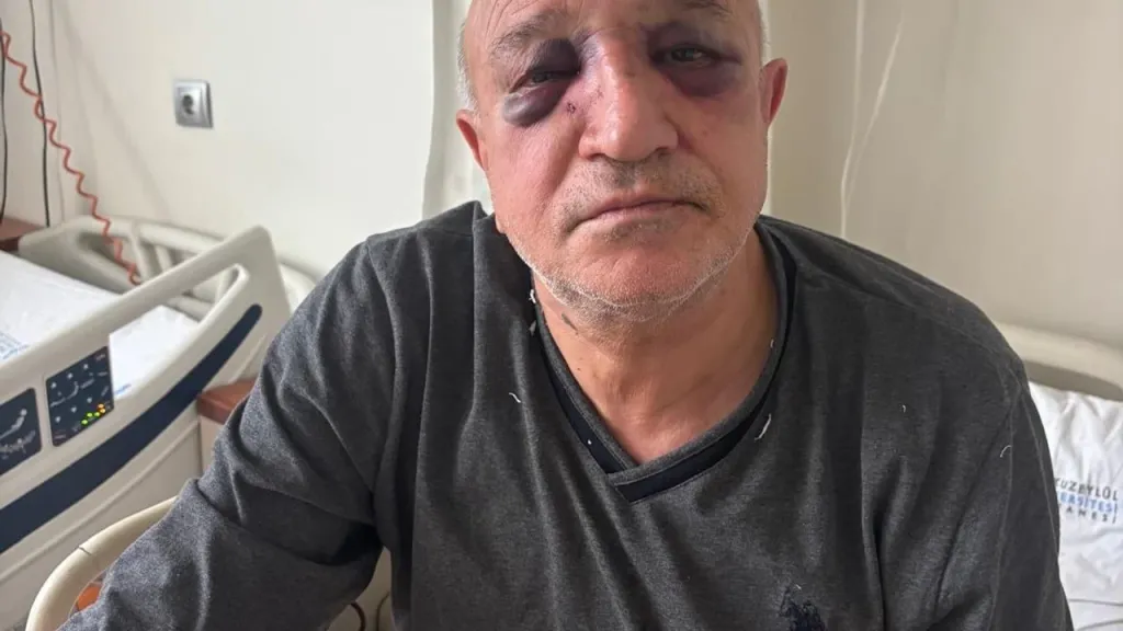 İzmir Büfeciler ve Kantinciler oda başkanına hain saldırı